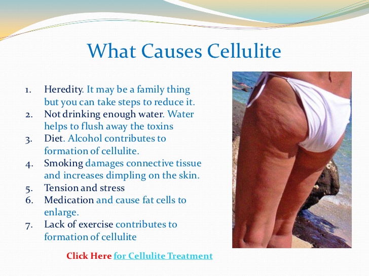best-products-for-cellulite-3-728.jpg