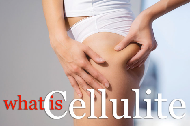 lk-articles-what-is-cellulite-658x437.jpg